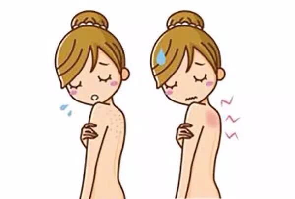 醉蠶：令人煩惱的濕疹，桑葚酒有妙方